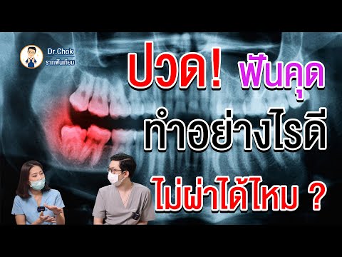 ปวดฟันคุดทำอย่างไรดี ? ไม่ผ่าได้หรือป่าว ?  | คลายปัญหา รากฟันเทียม กับ หมอโชค